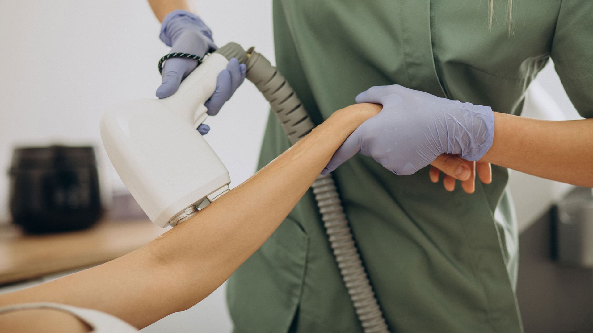 Como prevenir queimaduras na pele após depilação a laser?