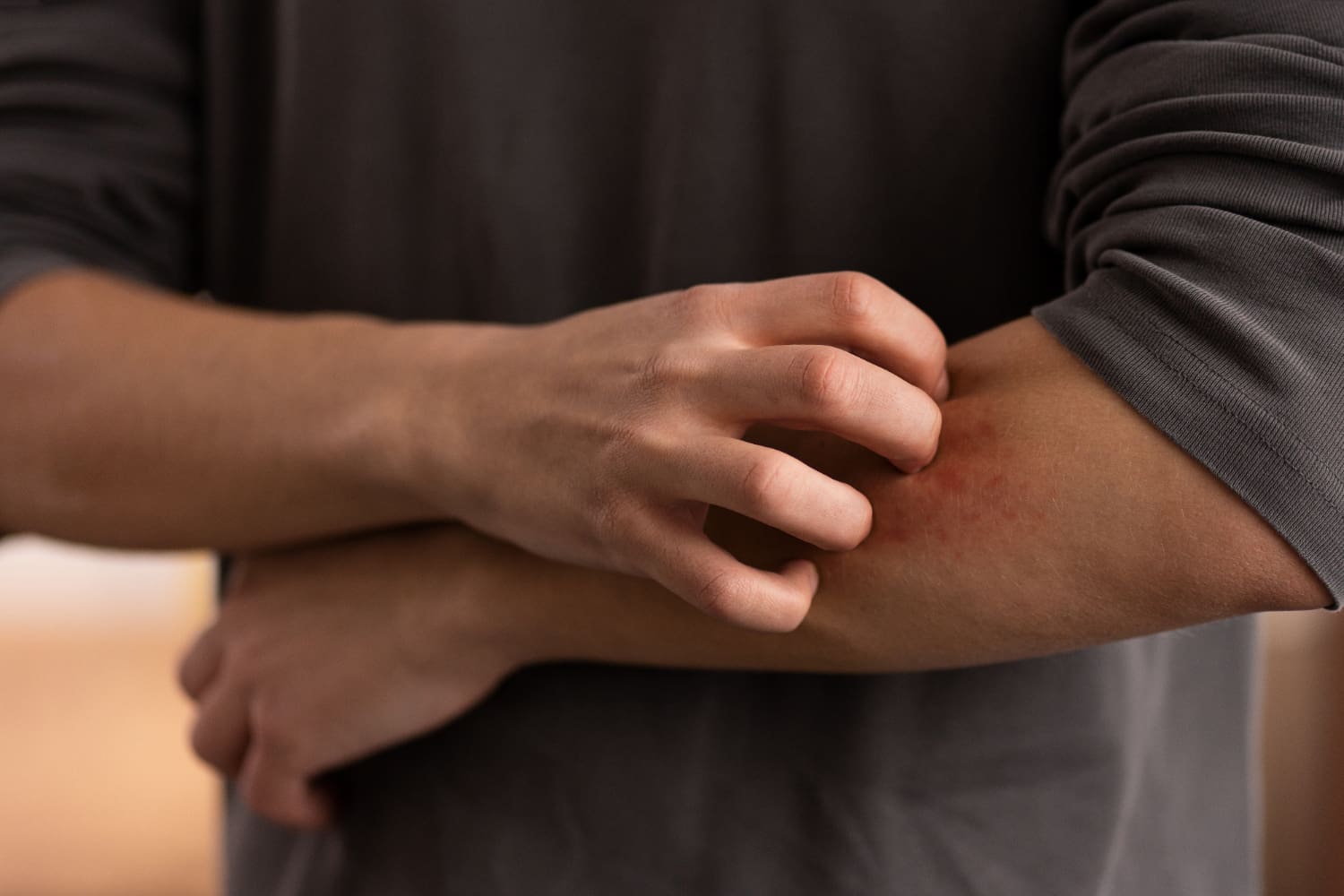 Alergia na Pele: Causas, Sintomas e Tratamentos Eficazes