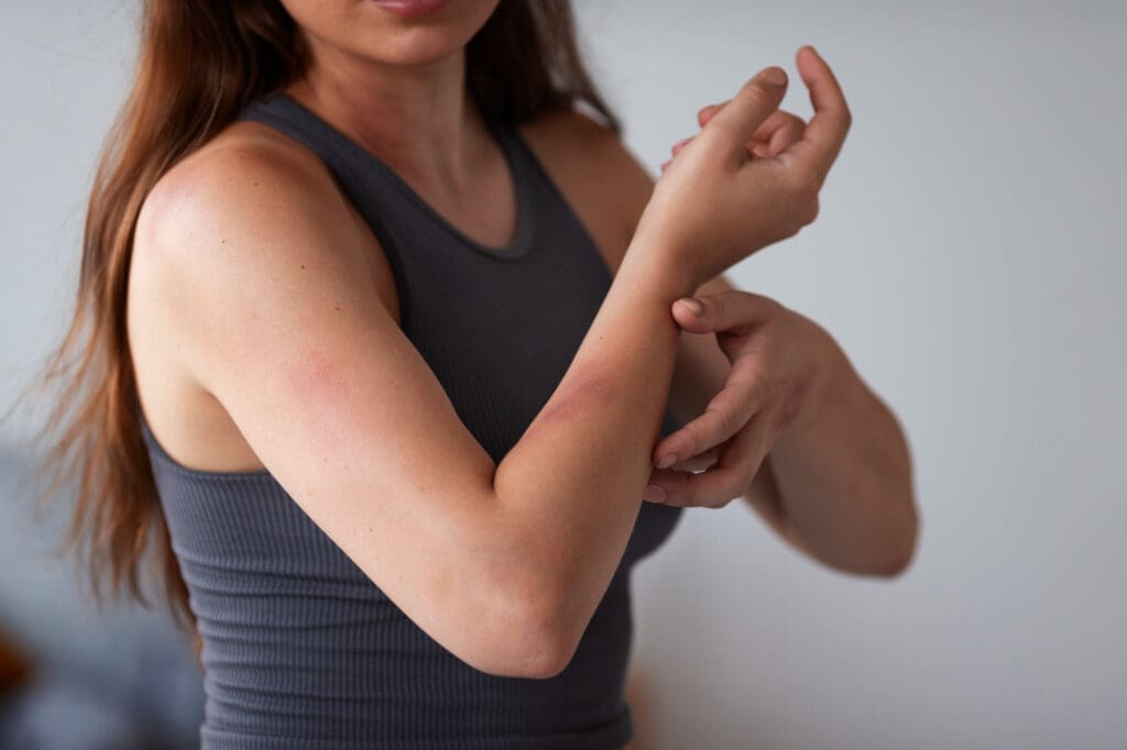 Pele Irritada: Cuidados Essenciais para Tratar e Prevenir